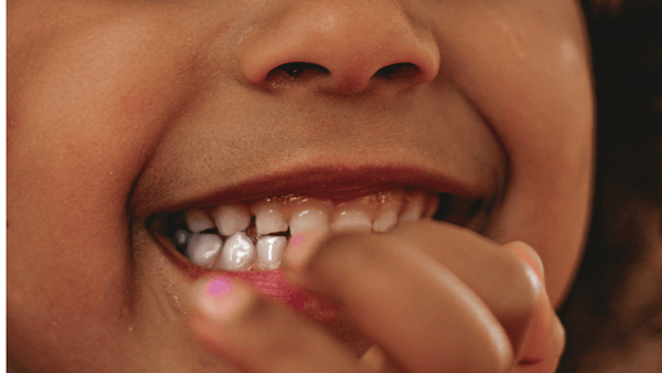 a young child with her teeth