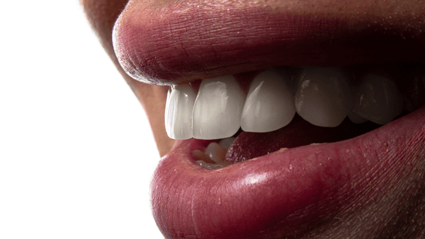 A person smiling with her teeth out
