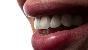 A person smiling with her teeth out