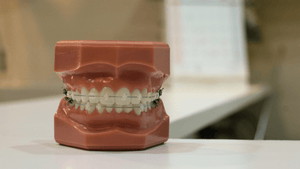 Photo of a fake set of teeth in a dentist 